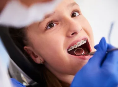 aparat ortodontyczny u młodej kobiety podczas wizyty kontrolnej
